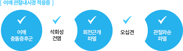 [어깨 관절내시경 적응증] 어깨 충돌증후군 / 석회성 건염 / 회전근개 파열 / 오십견 /  관절와순 파열