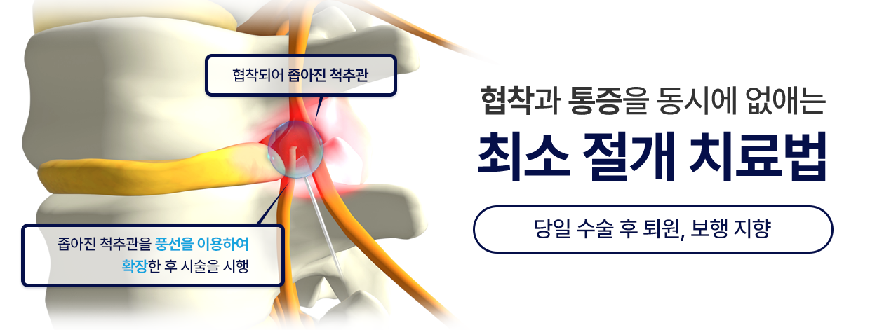 협착과 통증을 동시에 없애는 최소 절개 치료법. 당일 수술 후 퇴원, 보행 지향